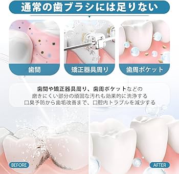 Amazon.co.jp: ジェットウォッシャー 口腔洗浄器 SONCCI 歯石取り 口腔